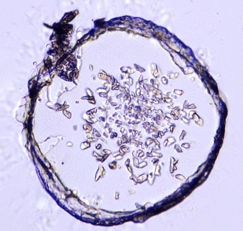 Crystals of the mGlu5 transmembrane domain